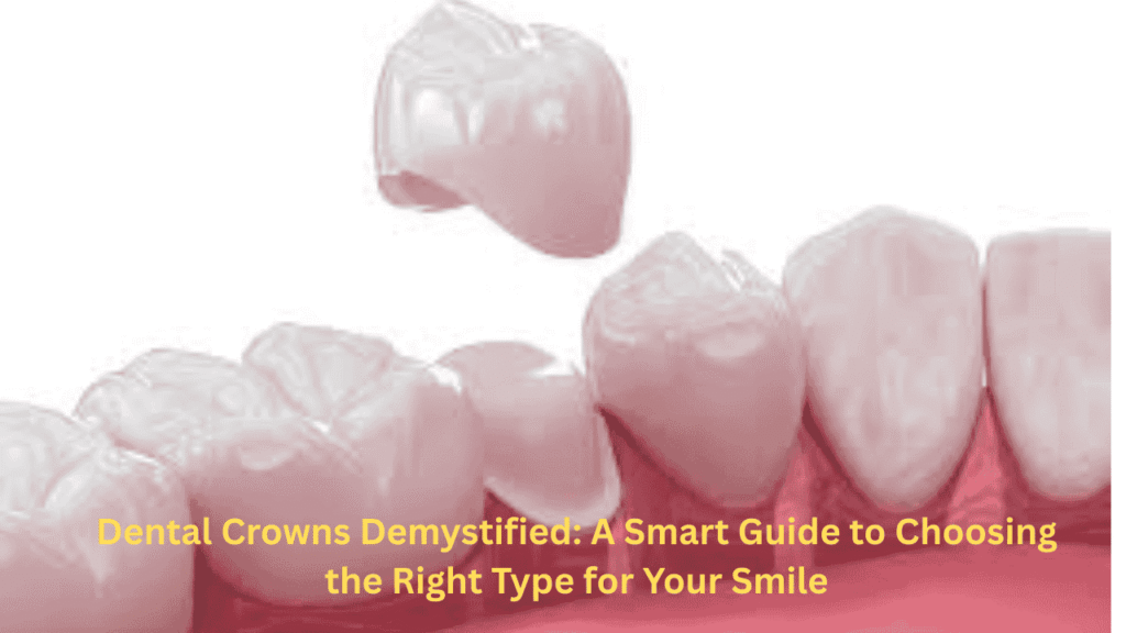 dental crowns demystified a smart guide to choosing the right type for your smile min (1)