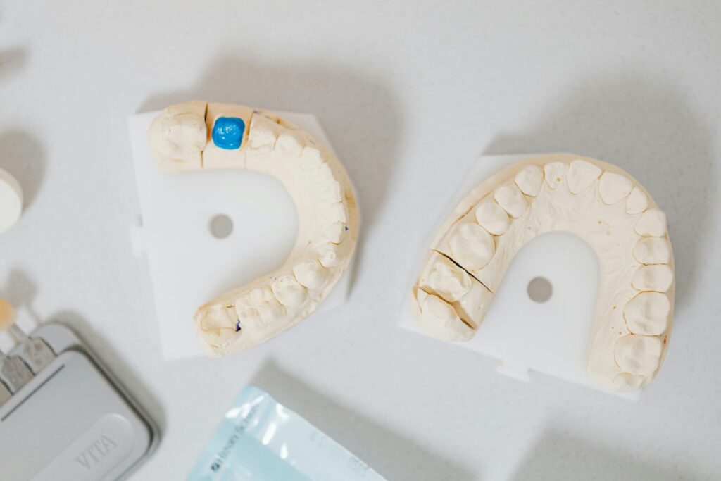 How Long Does it Take to Place a Dental Crown?
