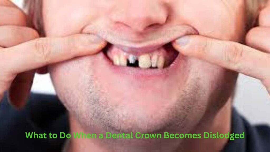 What to Do When a Dental Crown Becomes Dislodged
