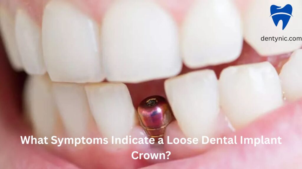 what-symptoms-indicate-a-loose-dental-implant-crown