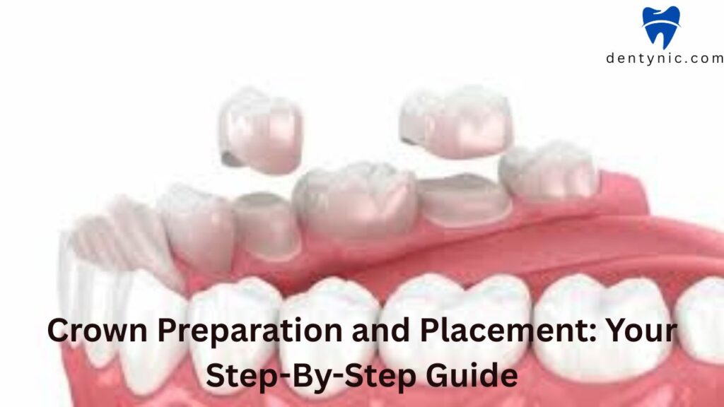 crown-preparation-and-placement-your-step-by-step-guide